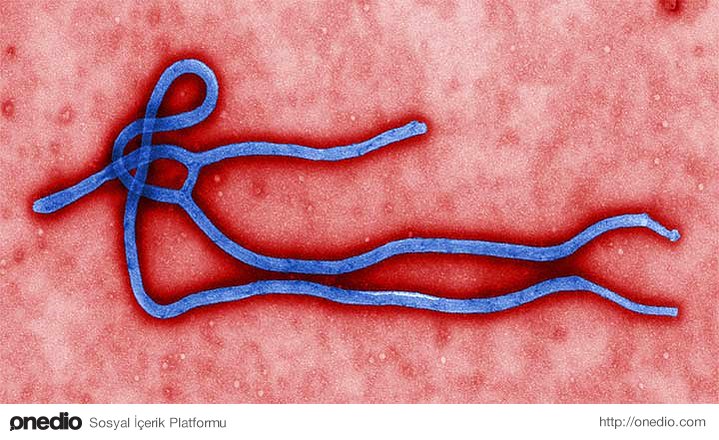 Ebola virüsü, ipliksi yapıda, yaklaşık 80 nm boyundadır. Genetik materyali RNA'dan oluşur